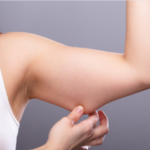 Reduce Arm Fat Naturally